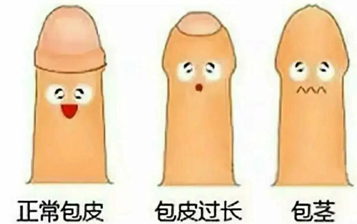包皮过长图片